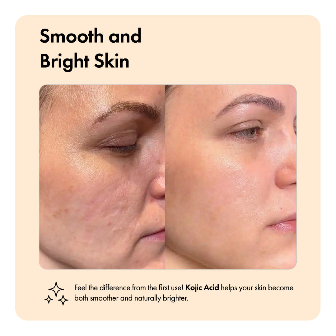 Kojiso™ Spot Serum