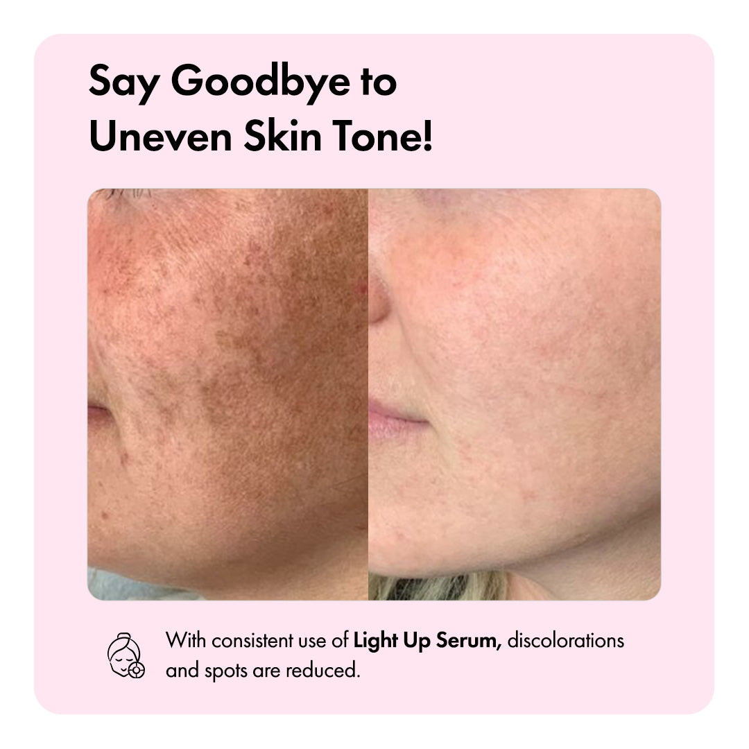 Light Up™ Brightening Serum