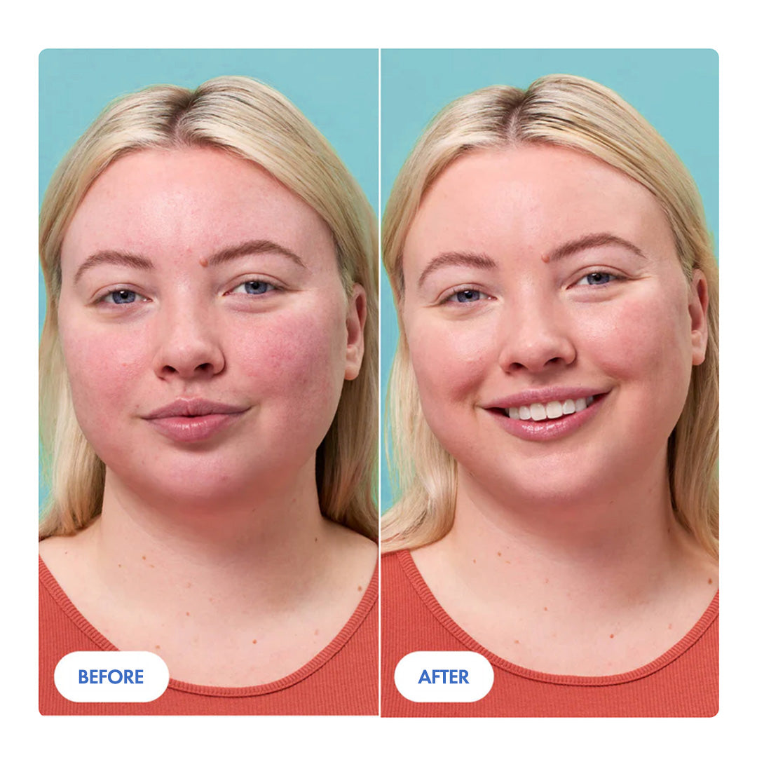 Anti-Redness Soothing Serum