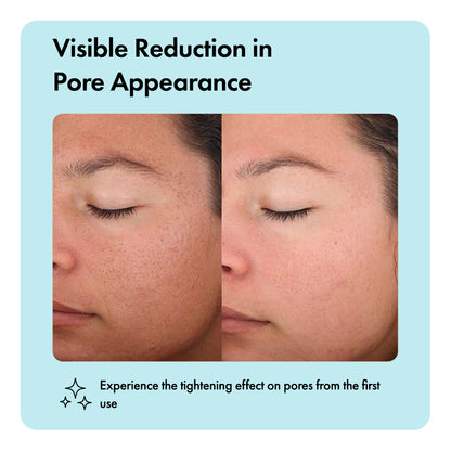 Zero Pore™ Cleansing Bar