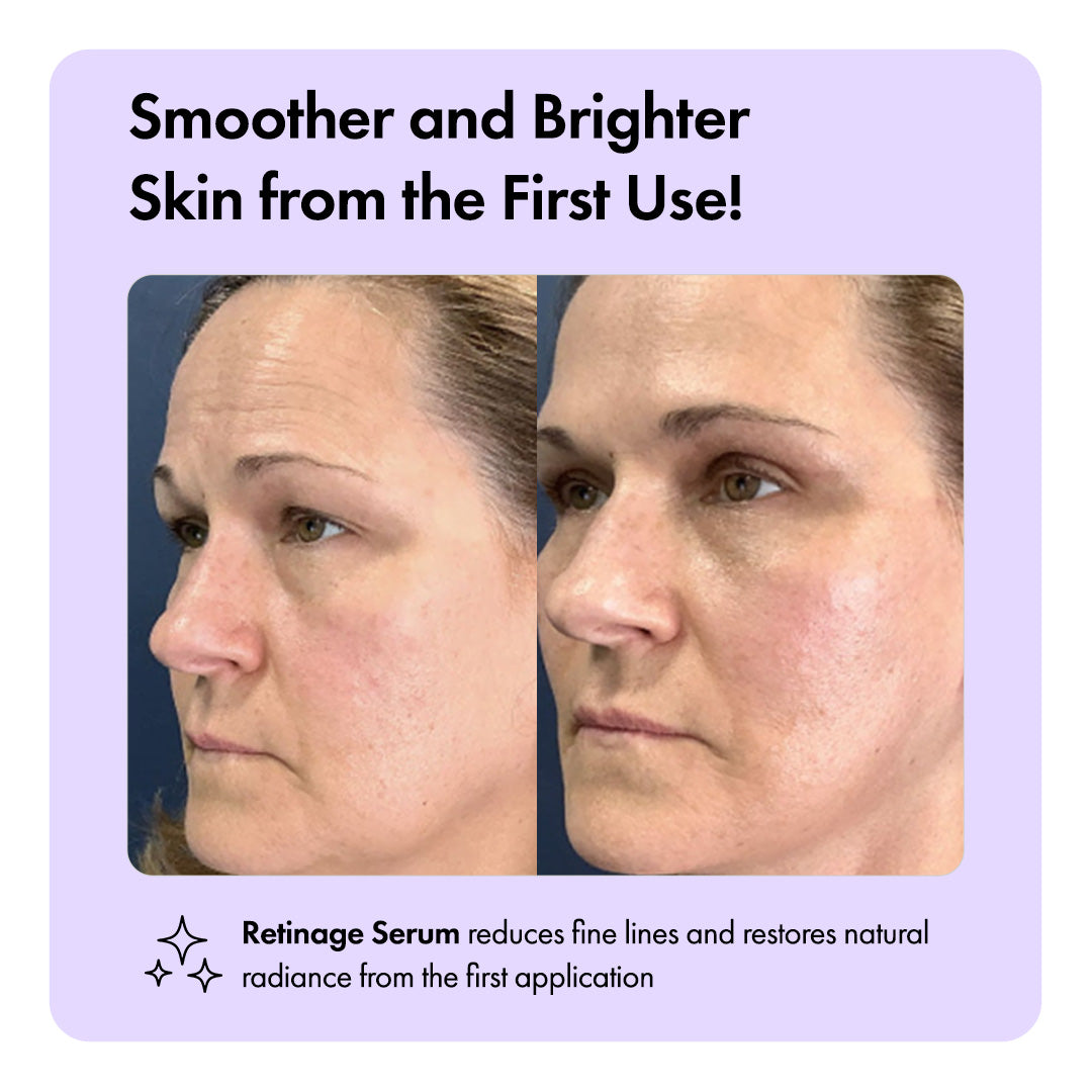 Retinage™ Anti Aging Serum