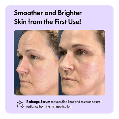 Retinage™ Anti Aging Serum