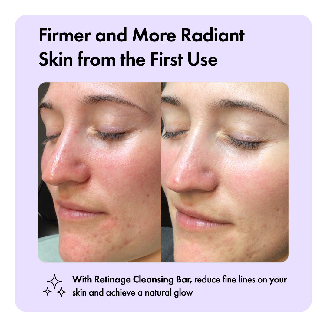 Retinage™ Cleansing Bar