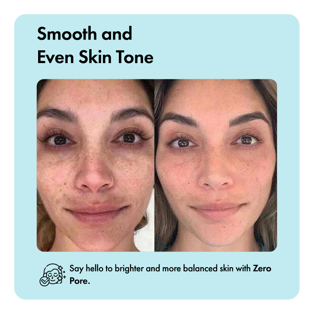 Zero Pore™ Cleansing Bar